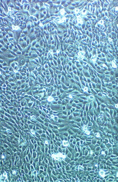 Rippling patterns of sunlight reflect off the surface of clear blue water, creating swirling, wavy lines—like the innovative pathways a medical device company forges across the textured, liquid background.